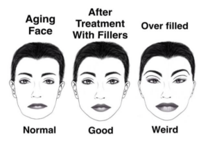 fillers graphic