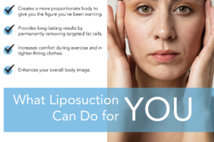 What Liposuction Can Do for You thumb