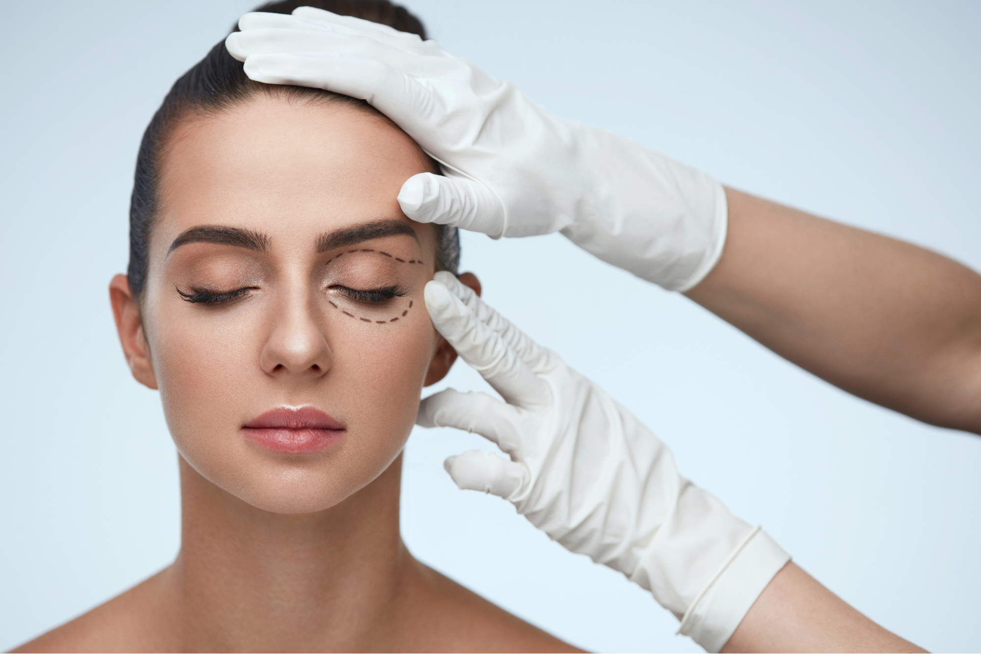 Pre-Surgery Checklist: Essential Steps to Prepare for Eyelid Surgery