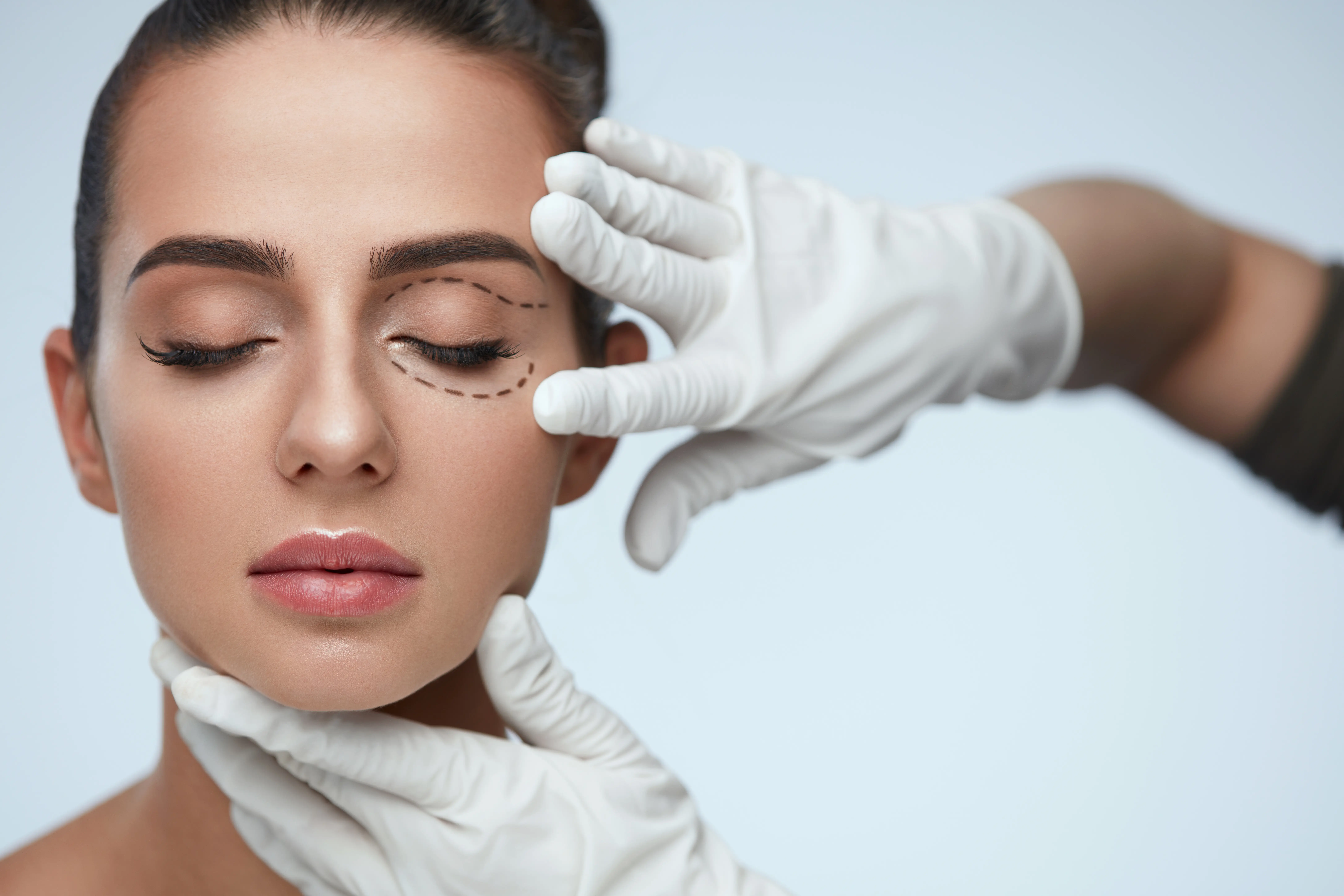 Clinician marking upper and lower eyelid areas before an eyelid procedure