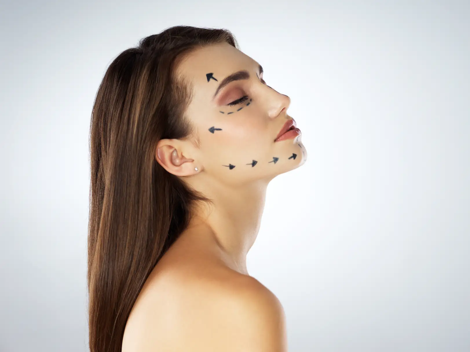 Woman with facial markings for cosmetic facial contour planning